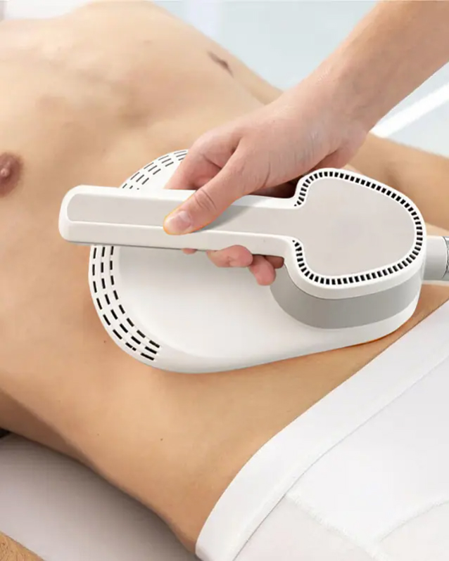EMSlim - manipulă aplicată pe abdomen pentru contracții HIFEM supramaximale