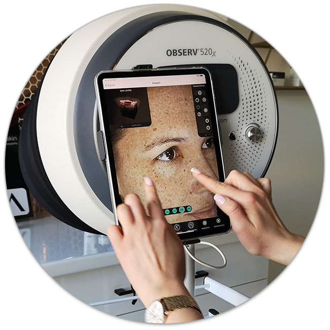 Observ 520x - analiză facială